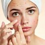 Acne Prevention – Some Fundamental Methods that actually work!
